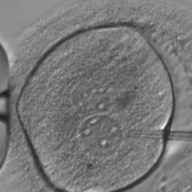 '중국 과학자 세계에서 첫 유전자 아기 때문에 병원에 편집, 부인, 국제 부르다