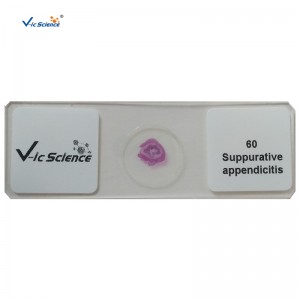 100pcs 키트 인간의 병리학 미시적 슬라이드 준비 슬라이드